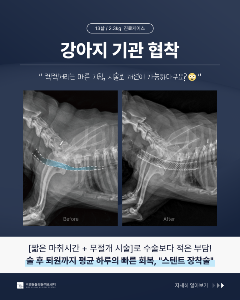 기관스텐트