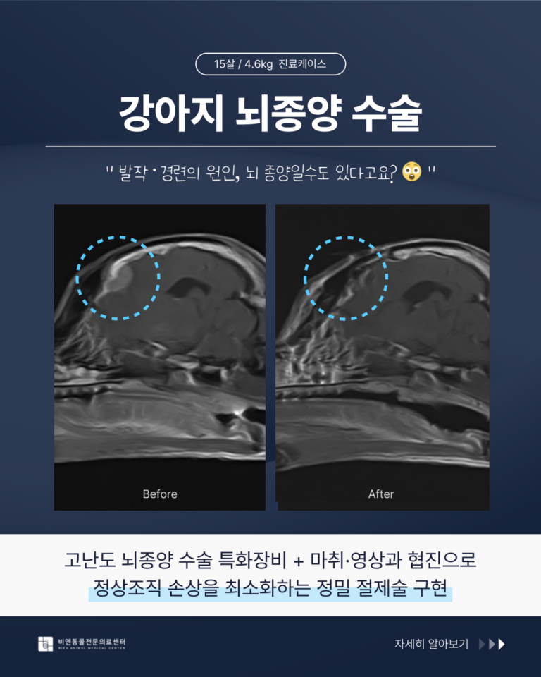 뇌종양