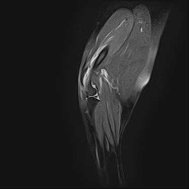 ctmri-g001