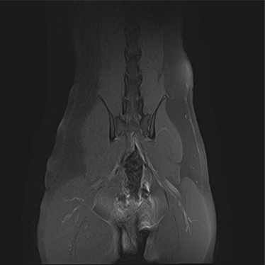 ctmri-g002