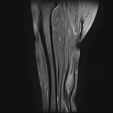 ctmri-g003