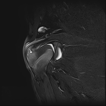 ctmri-g004