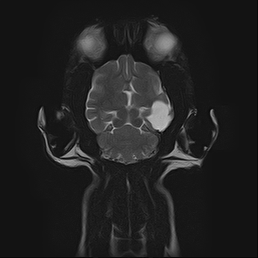 ctmri-g009