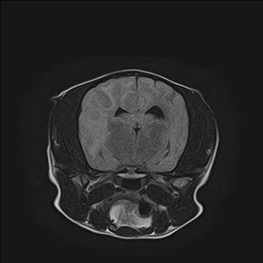 ctmri-g011