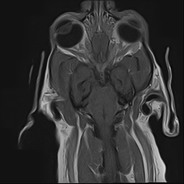 ctmri-g014
