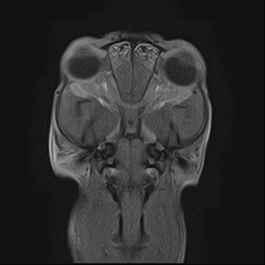 ctmri-g015