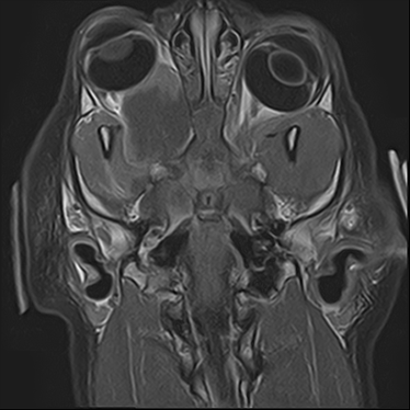 ctmri-g016
