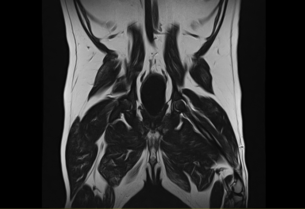 관절 · 신경 MRI