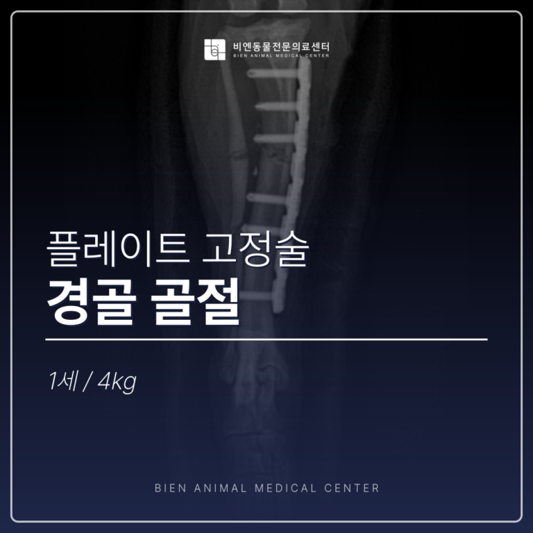 경골골절