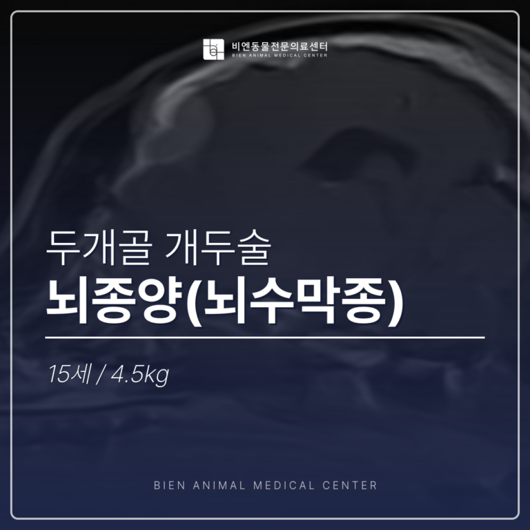 뇌종양