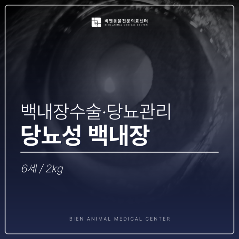 당뇨성 백내장
